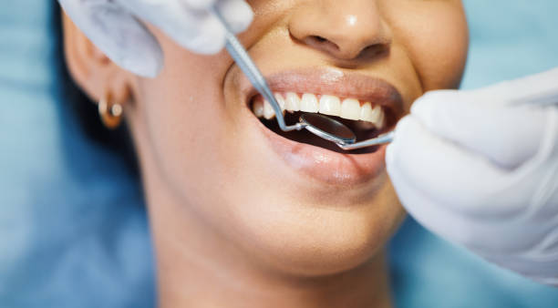 Best Emergency Dentist Near Me  in Deerfield, MI